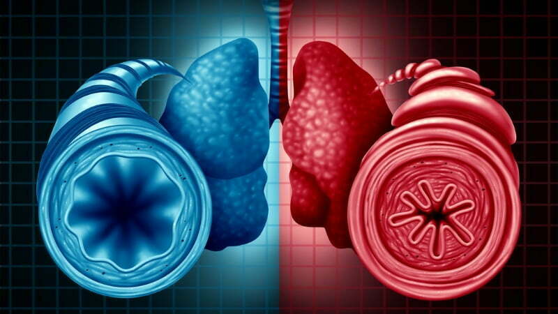 Detailed lung cell map uncovers new items of the allergic reactions puzzle