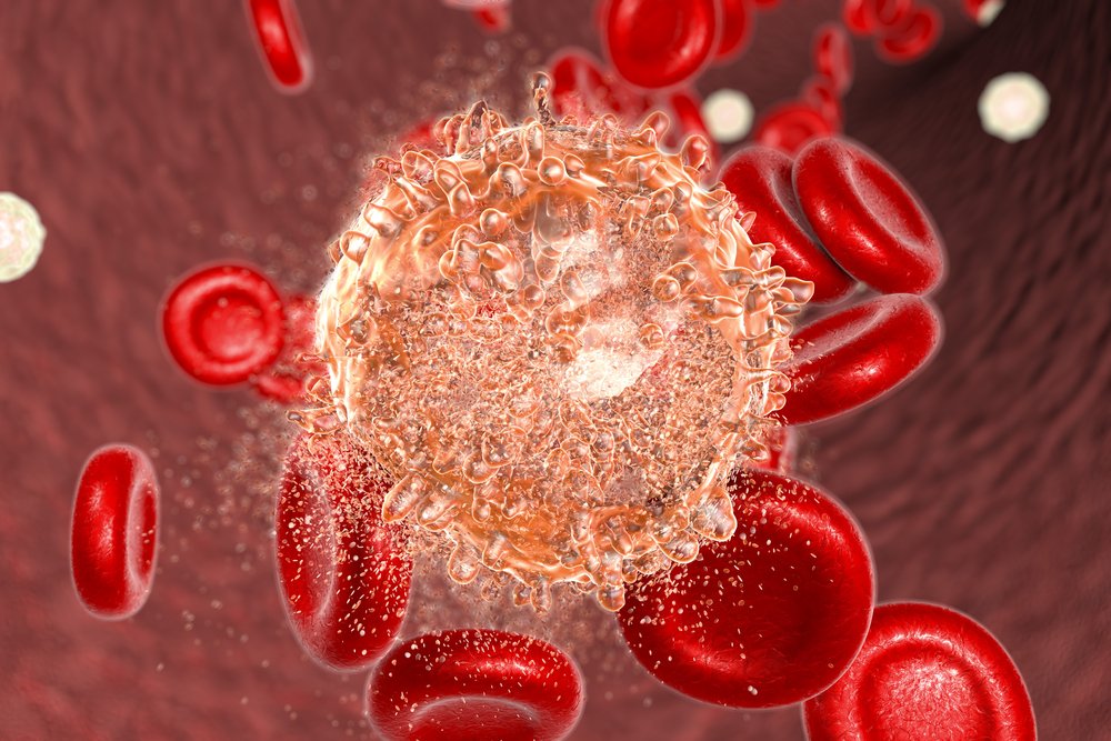Noninvasive Laser Kills Most cancers Cells within the Blood