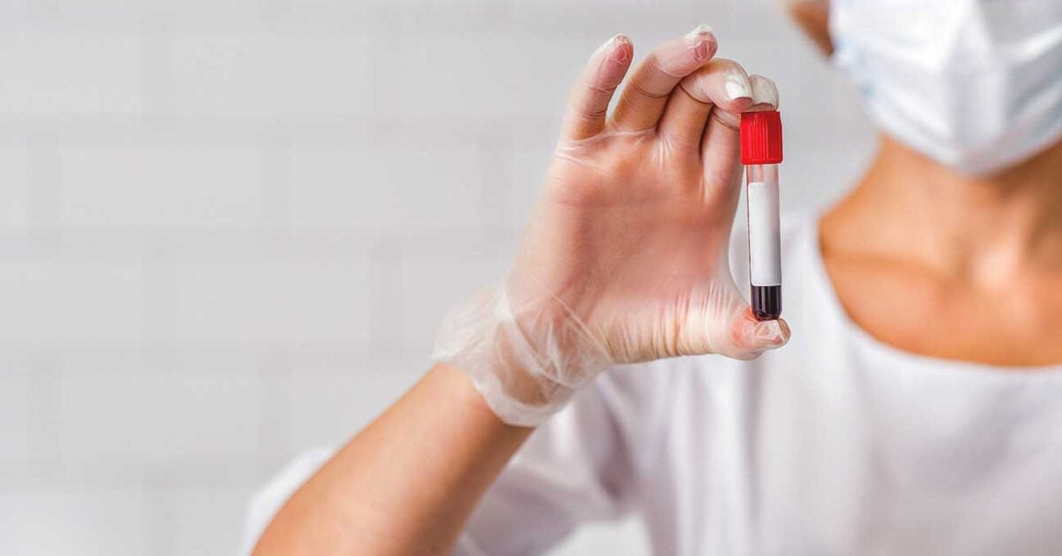 Amid present COVID-19 issues, STDs proceed to rise to unprecedented ranges